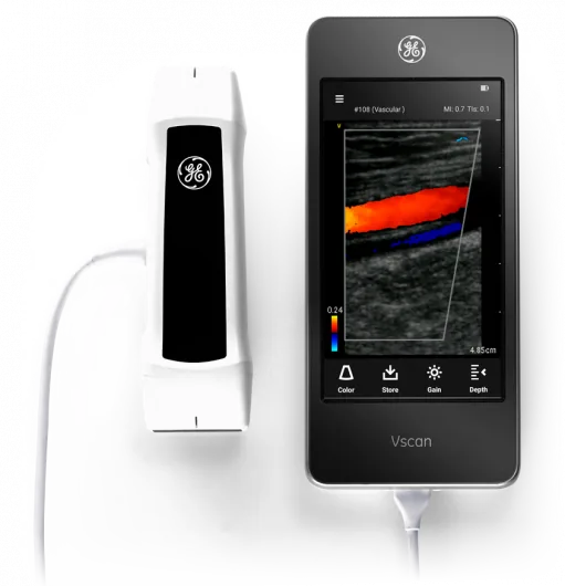 Ультразвуковая система General Electric VSCAN EXTEND