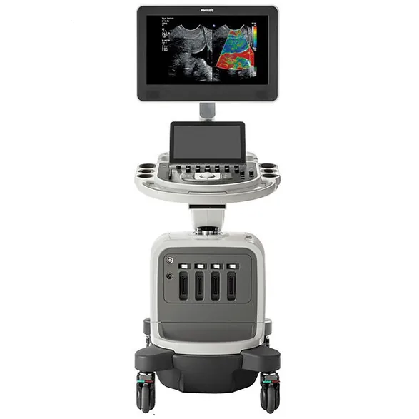 Ультразвуковая система Philips AFFINITI CVX